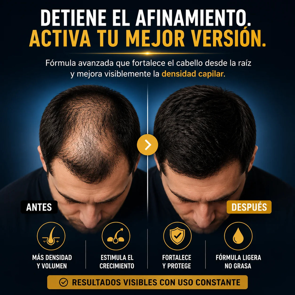 ¿Cada día ves más cabello en la almohada o en la ducha?