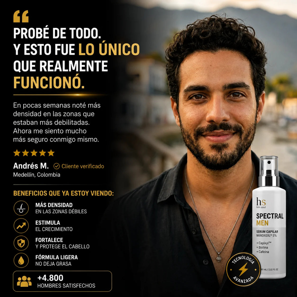 ¿Cada día ves más cabello en la almohada o en la ducha?