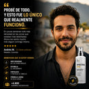 ¿Cada día ves más cabello en la almohada o en la ducha?